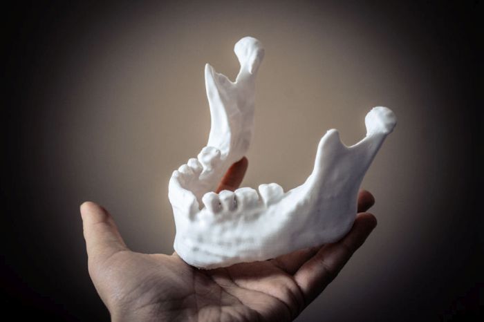 3D nyomtatással elő állított emberi állkapocs (szintetikus anyagból)